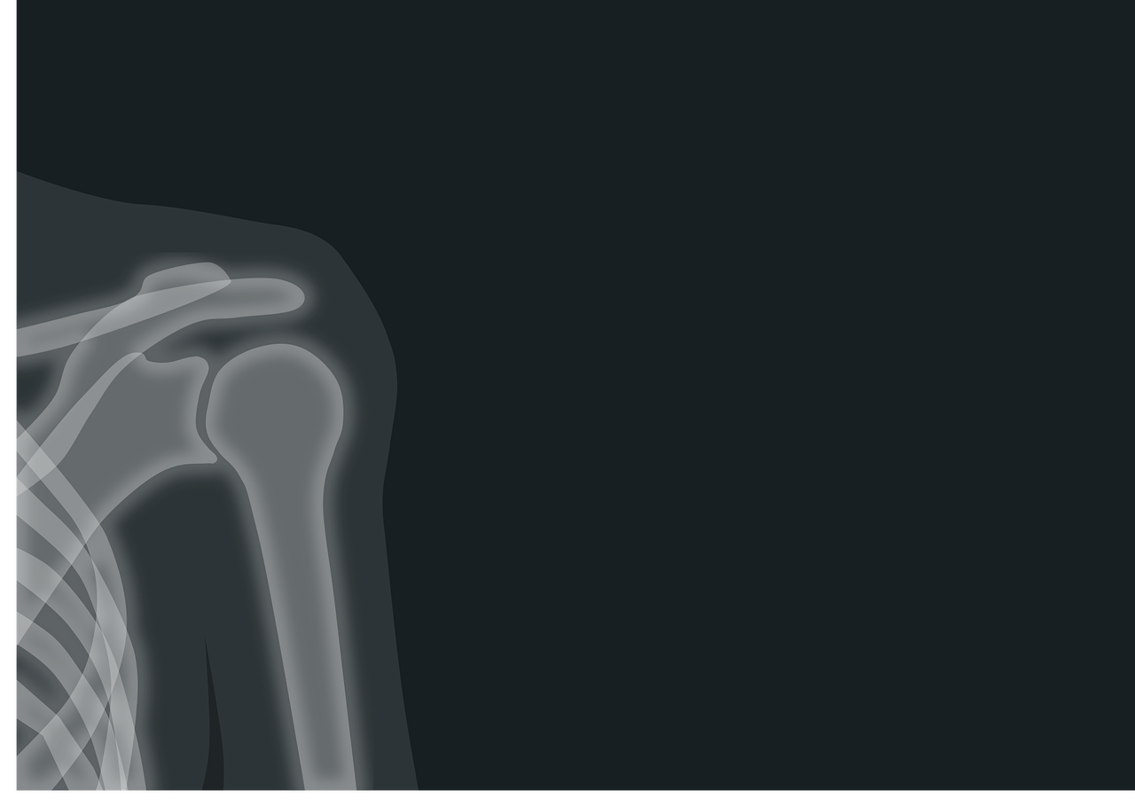 roentgen, x-ray image, radiation-1884888.jpg